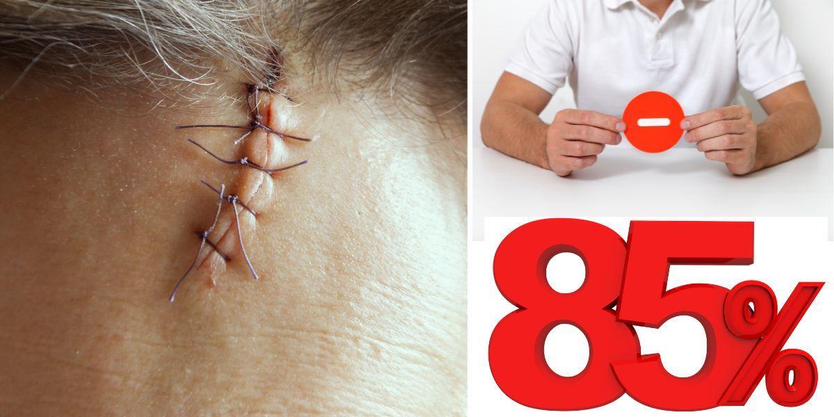 En kvinna har sytt pannan. En 85-årig kvinna fick ett sår i pannan efter ett fall och fick ersättning för ärr från sitt försäkringsbolag, men de gjorde ett 85-procentigt åldersavdrag på ersättningssumman. Det är inte kvinnan i texten vars panna syns på bilden