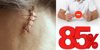 En kvinna har sytt pannan. En 85-årig kvinna fick ett sår i pannan efter ett fall och fick ersättning för ärr från sitt försäkringsbolag, men de gjorde ett 85-procentigt åldersavdrag på ersättningssumman. Det är inte kvinnan i texten vars panna syns på bilden