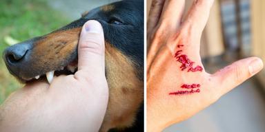 En hund biter en hand och en hand har fått ett bett. Det kan vara livsfarligt att bli biten av en gathund på en utlandsresa eftersom den kan bära på rabies