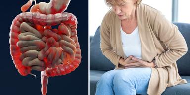 Tarmar och en kvinna har ont i magen. Forskare har hittat någonting som i framtiden skulle kunna bidra till nya behandlingar mot tarmsjukdomar som IBS och IBD.