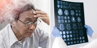 En man ed demens och en läkare tittar på MRI-bilder av hjärnan