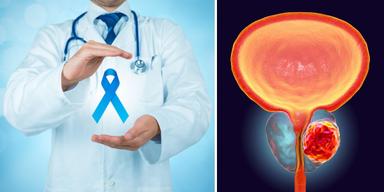 Till vänster, en läkare håller ett blå bandet, en symbol för kampen mot prostatacancer. Till höger en illustration av en cancertumör i prostatan, som sitter under urinblåsan, urinröret går igenom prostatan