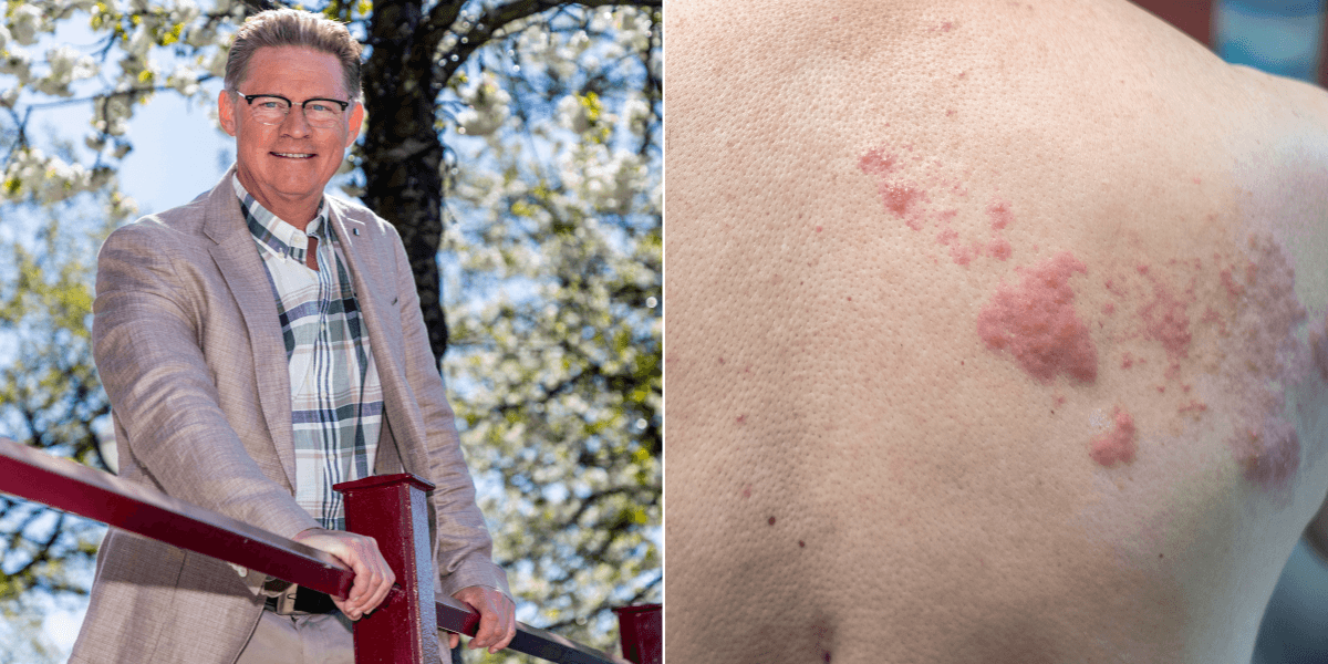 En man i kostym till vänster och en rygg med bältros till höger.