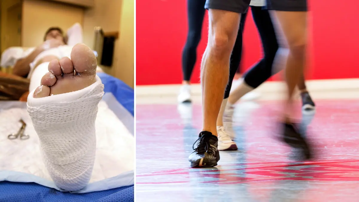 En person med brutet ben på grund av benskörhet till vänter och människor som tränar till höger.