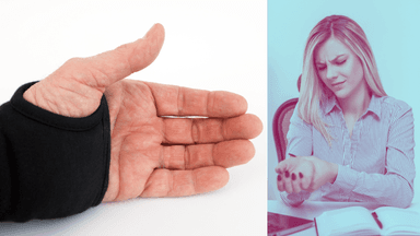 En hand med handledsskena till vänster och en kvinna med karpaltunnelsyndrom till höger.